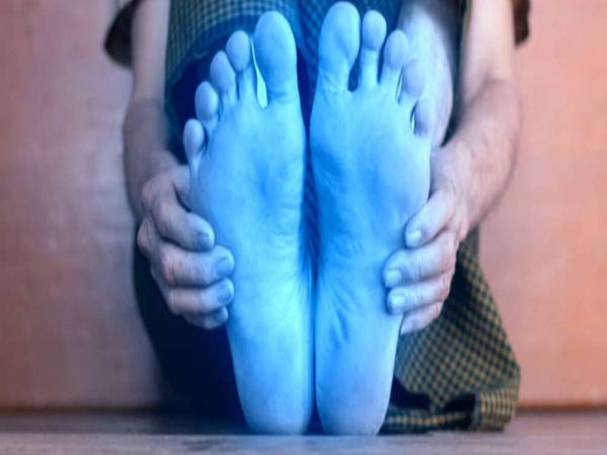 health news cold feet vitamin b12 deficiency रजाई में भी गर्म नहीं
