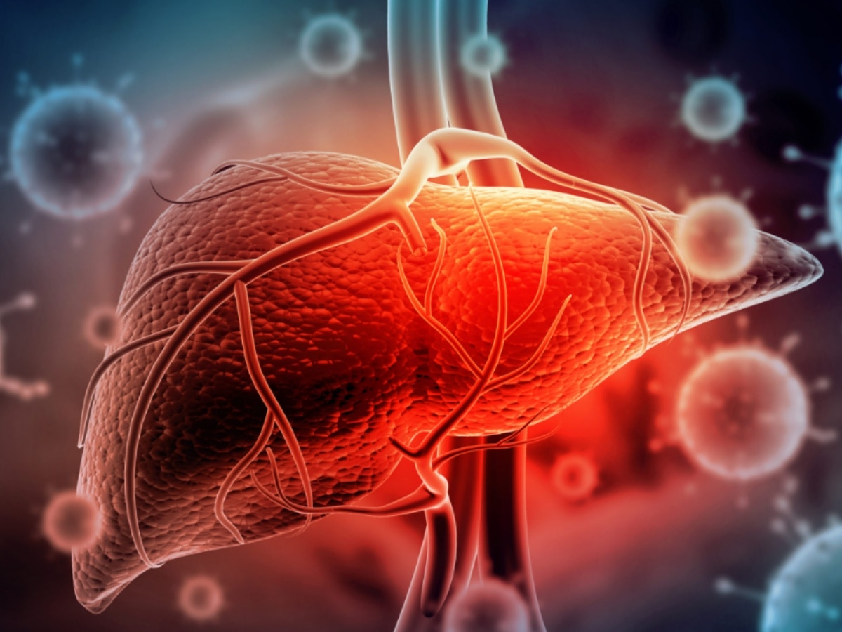 Hepatitis: लीवर को अंदर से चबा डालती है ये बीमारी, जानें हेपेटाइटिस के प्रकार, लक्षण, बचाव और इलाज   