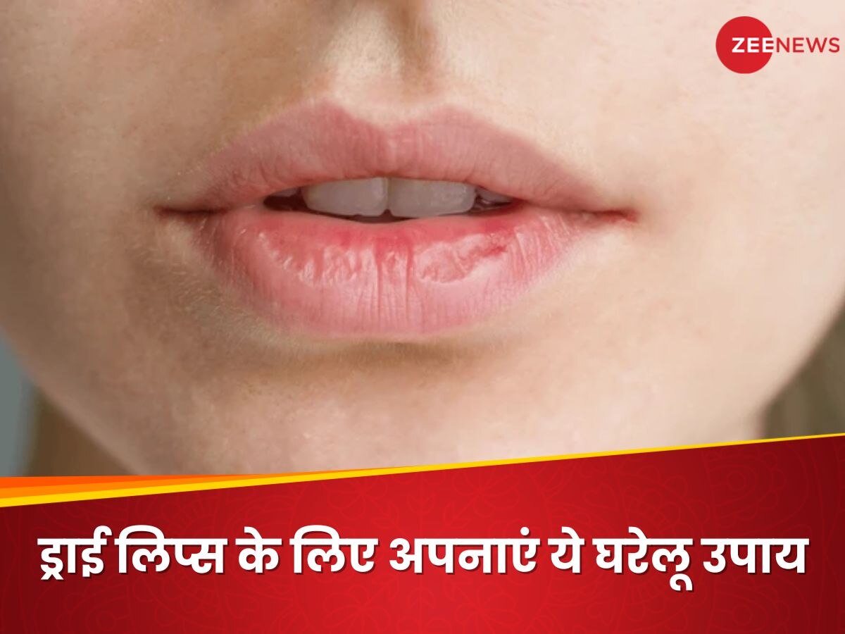 Winter Lips Care: सर्दियों में क्यों फटने लगते हैं होंठ? ड्राई लिप्स के लिए अपनाएं ये घरेलू उपाय