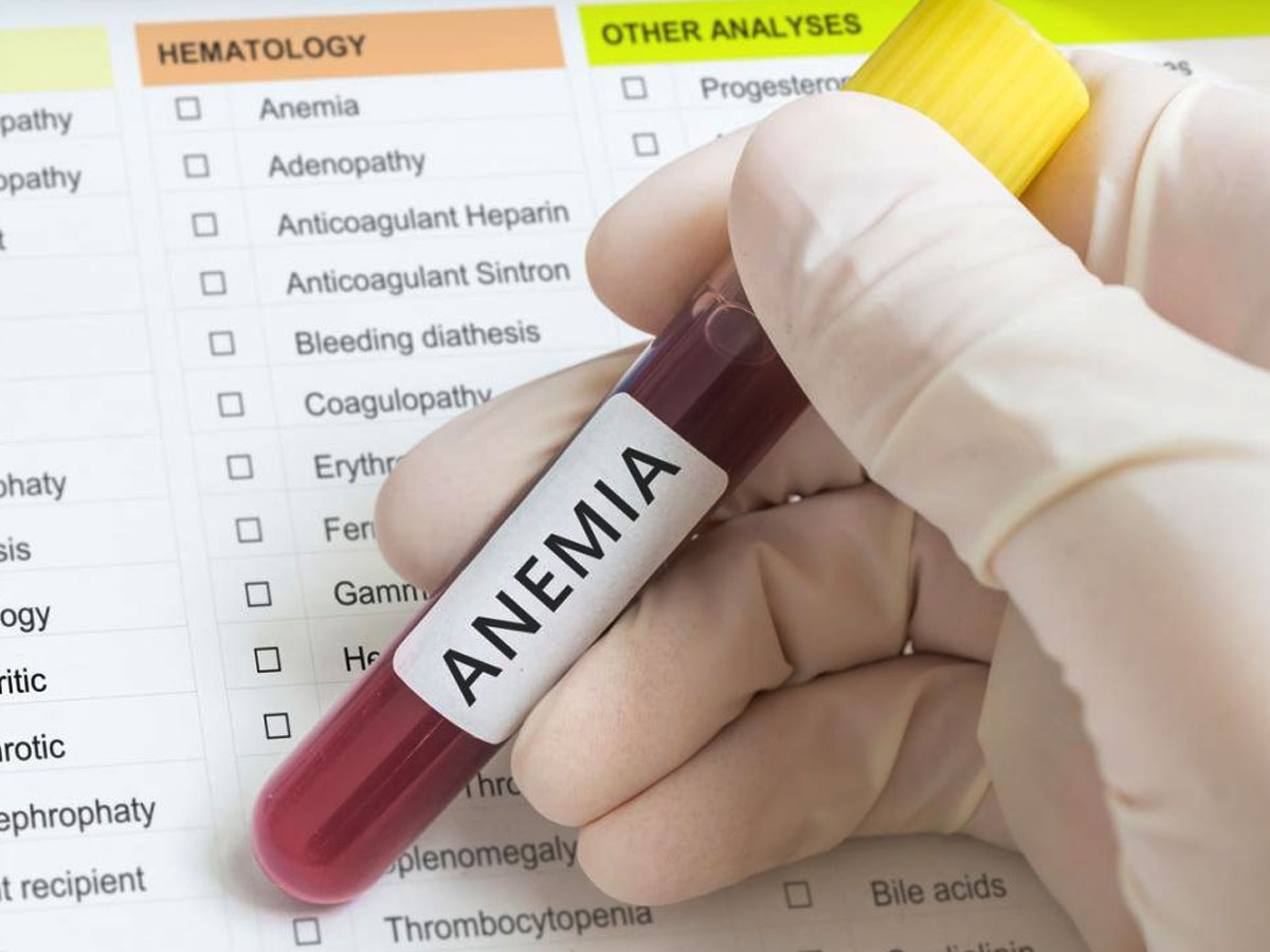 एनीमिया से बचाव