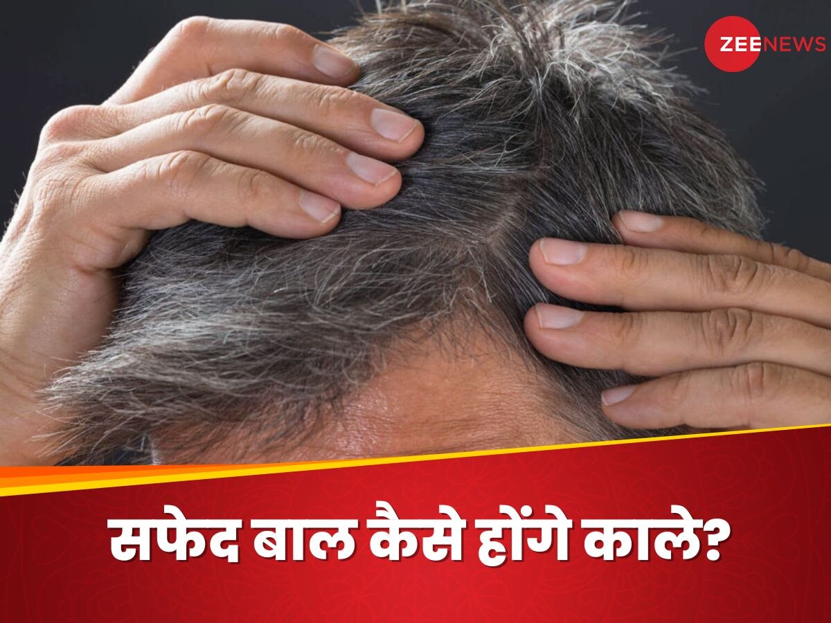 White Hair: शादी से पहले सफेद बाल उगने की वजह से बच्चे कहने लगे 'अंकल', जानिए वापस कैसे पाएं कालापन