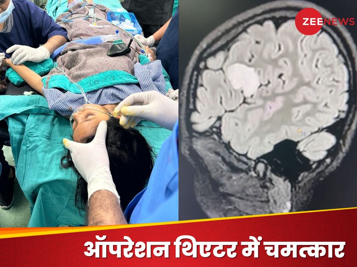 चमत्कार! जागती रही बच्ची, डॉक्टर करते रहे ब्रेन की सर्जरी, मेडिकल साइंस में दुनिया का पहला मामला