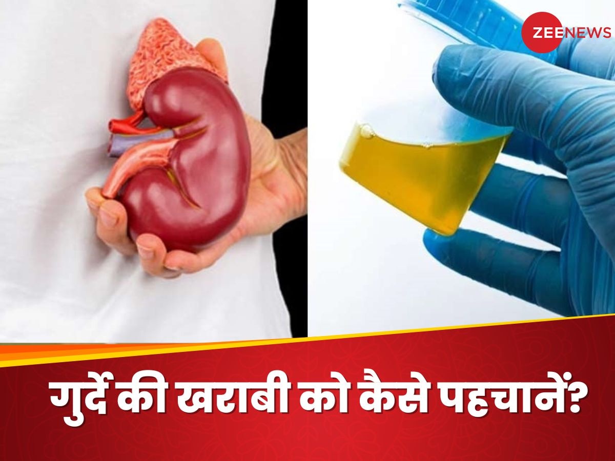 Kidney Disease: किडनी में प्रॉब्लम्स होने पर शरीर देता है कुछ ऐसे इशारे, इन्हें नजरअंदाज करना पड़ जाएगा भारी