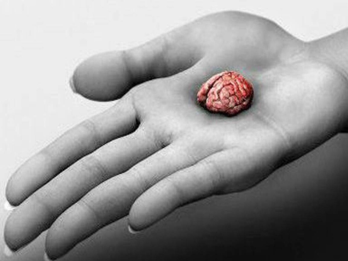 Mini Brain: इंसानी टिश्यू से बना दुनिया का पहला &#039;मिनी ब्रेन&#039;, जानें इससे क्या फायदा होगा?