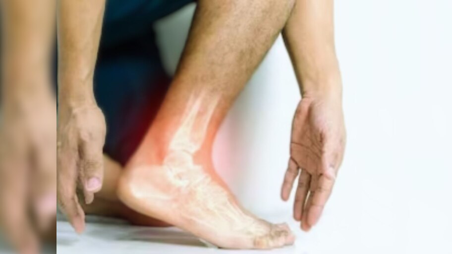 Uric Acid: यूरिक एसिड से हैं परेशान, इस तरह करें कंट्रोल 