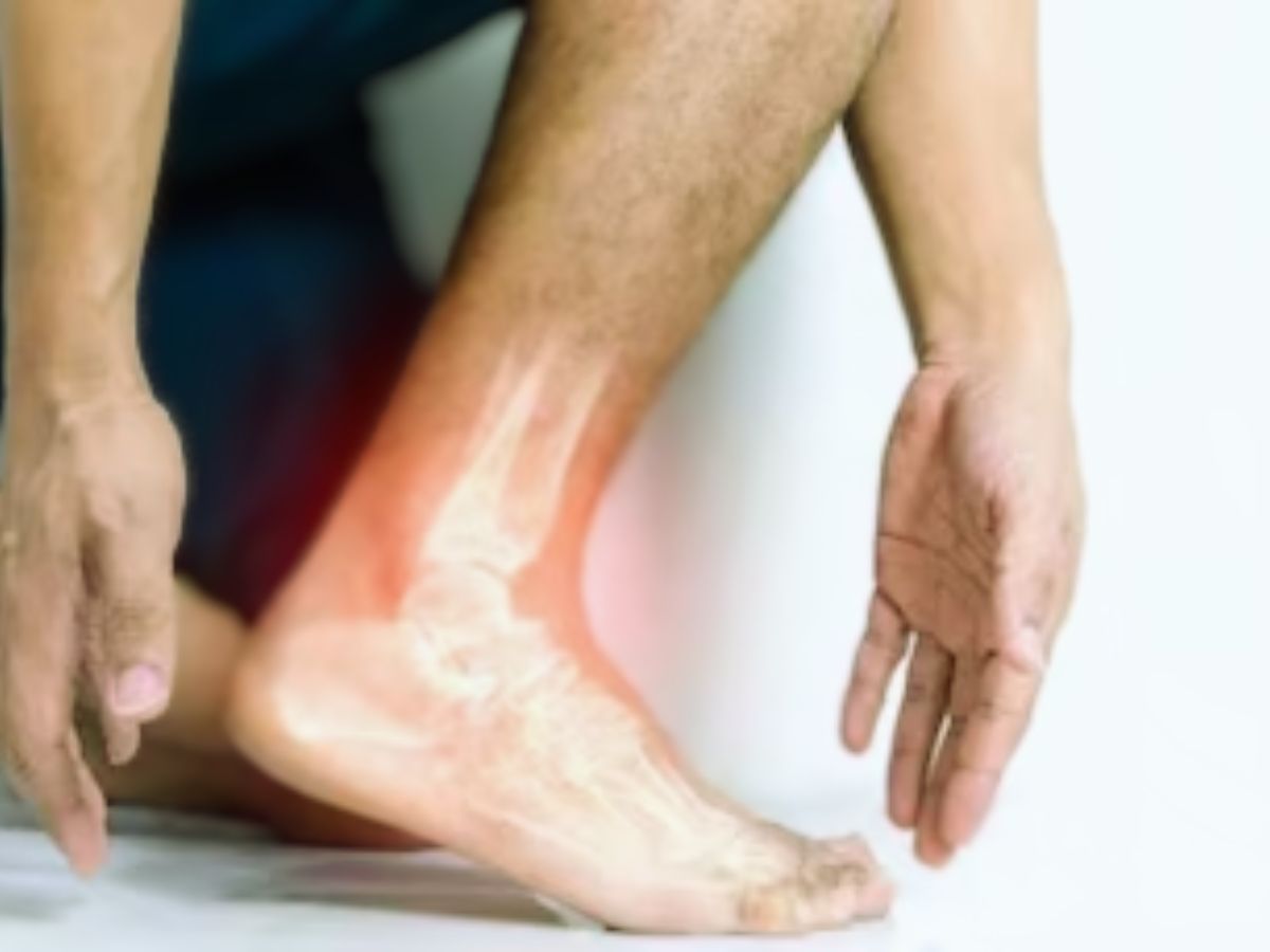 Uric Acid: यूरिक एसिड से हैं परेशान, इस तरह करें कंट्रोल Uric Acid: यूरिक एसिड से हैं परेशान, इस तरह करें कंट्रोल