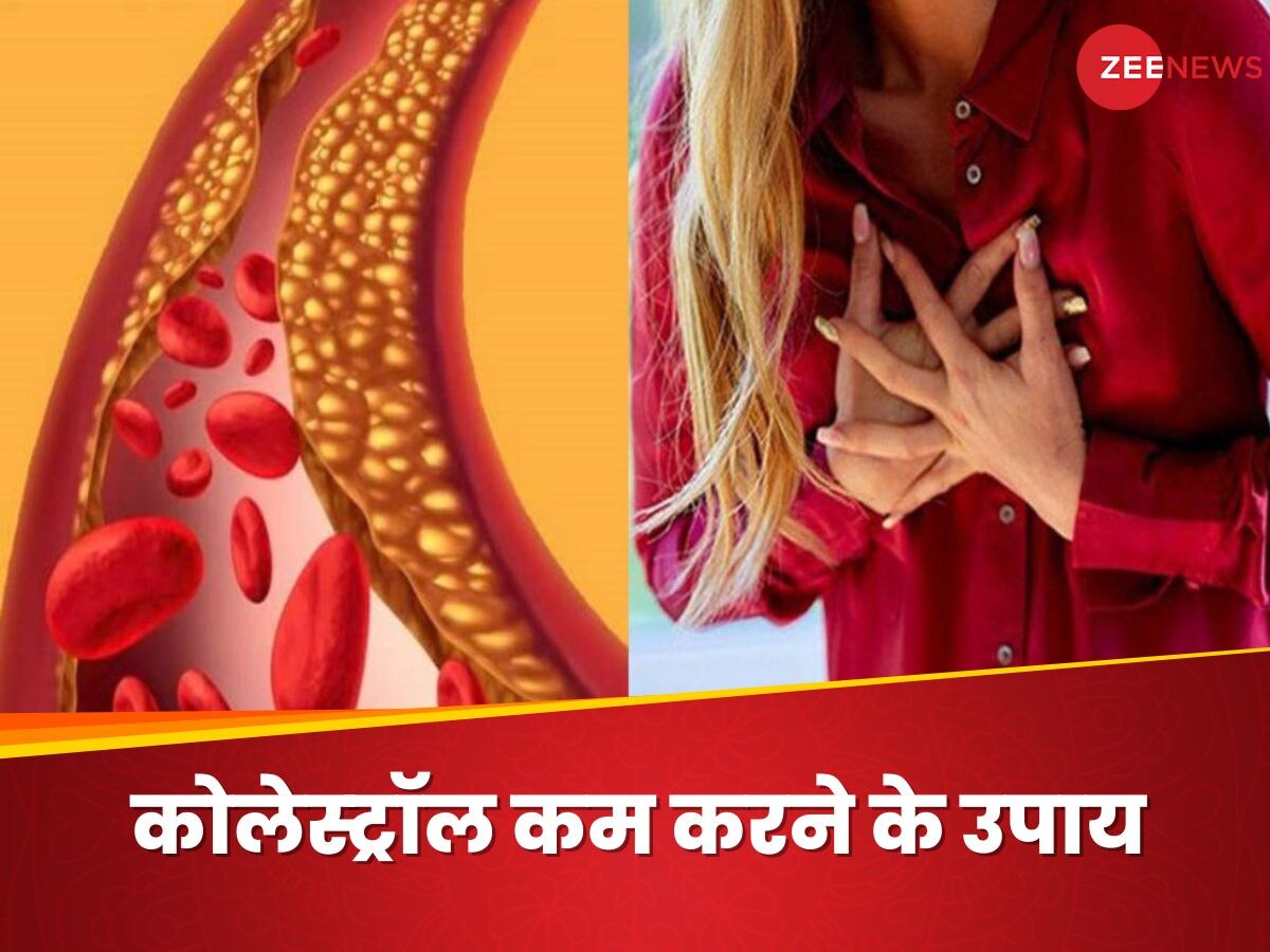 Bad Cholesterol की वजह से नसें होने लगी ब्लॉक? फूड हैबिट्स को ऐसे बदलें, मिलेगी राहत