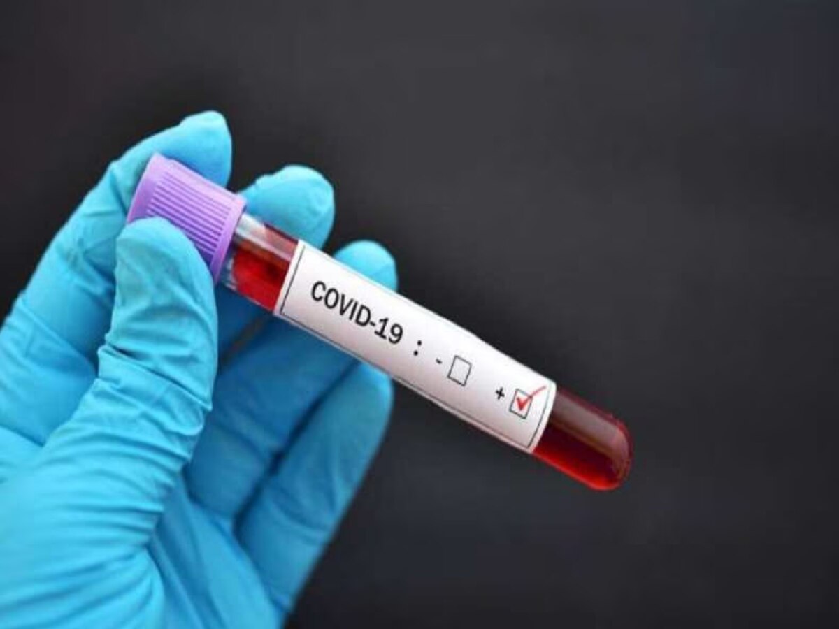 Coronavirus Update: देश में कोरोना वायरस के 441 नए मामले, जानें पूरी कोविड अपडेट