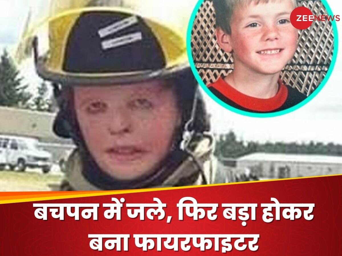 Inspiring: 6 साल की उम्र में बुरी तरह से जल गई थी लड़के का शरीर, बड़ा होकर बना फायरफाइटर्स