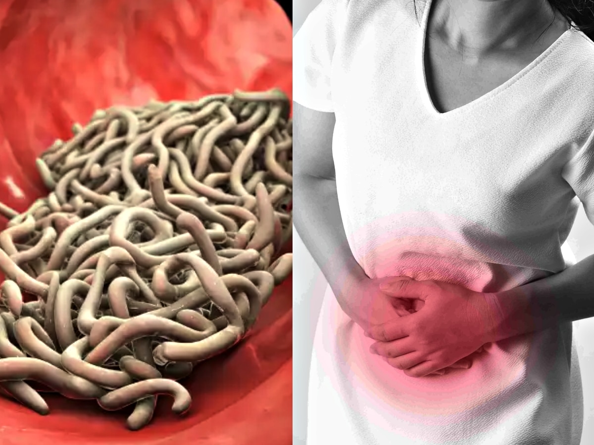 Stomach Worms Remedies: दिखें ये 5 लक्षण तो समझें पेट में हैं कीड़े