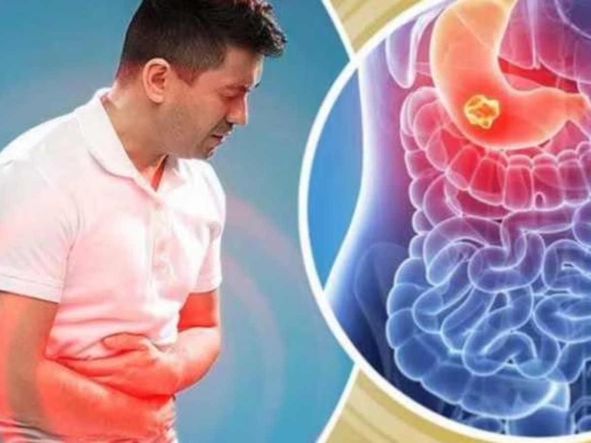 Stomach Worms Remedies दिखें ये 5 लक्षण तो समझें पेट में हैं कीड़े