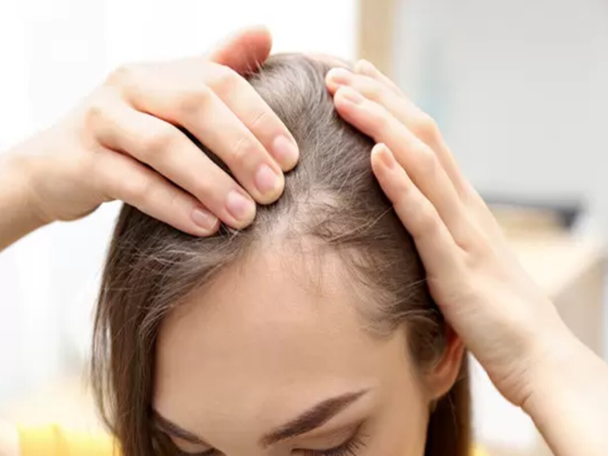 Ayurvedic Remedies for Hair Loss