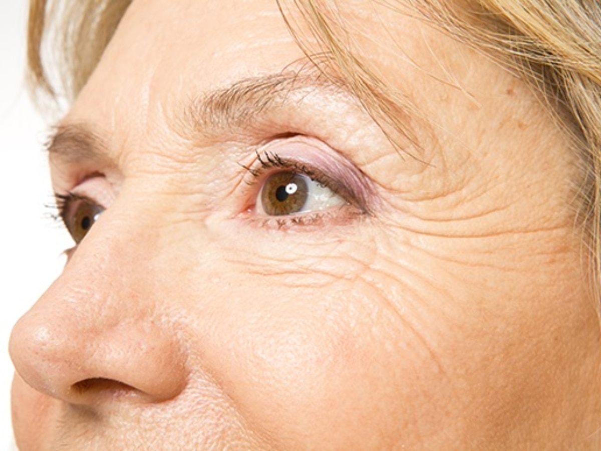 How to get rid of wrinkles under the eyes with home remedies