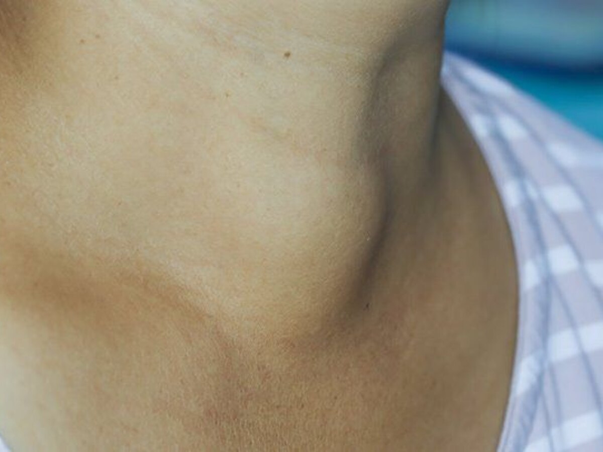 Thyroid Problem: थायराइड के हैं ये 4 कॉमन संकेत, भूल से न करें नजरअंदाज