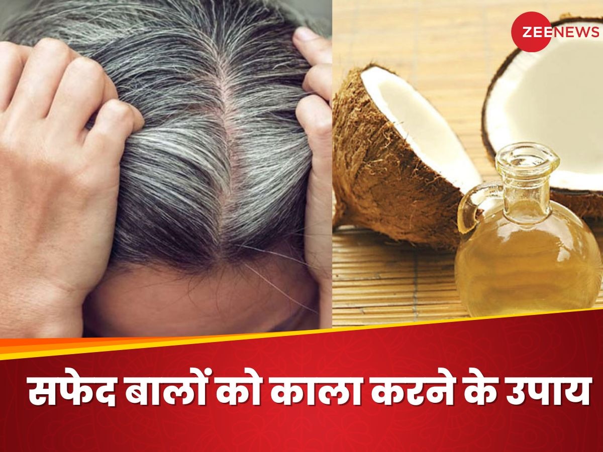 White Hair: सफेद बालों को नेचुरली काला बनाएगा नारियल तेल, इसमें 2 चीजों को कर लें मिक्स