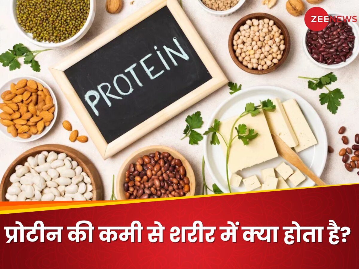 Protein Deficiency: प्रोटीन की कमी से सिर्फ कमजोरी नहीं, हो सकती हैं ये गंभीर समस्याएं