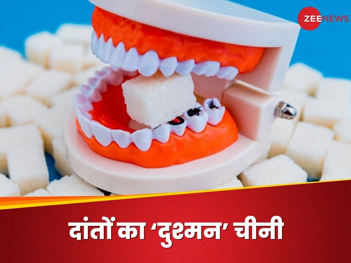 Teeth: दांतों के लिए क्यों नुकसानदेह है चीनी का सेवन? ओरल हेल्थ का हो जाता है 'कबाड़ा'