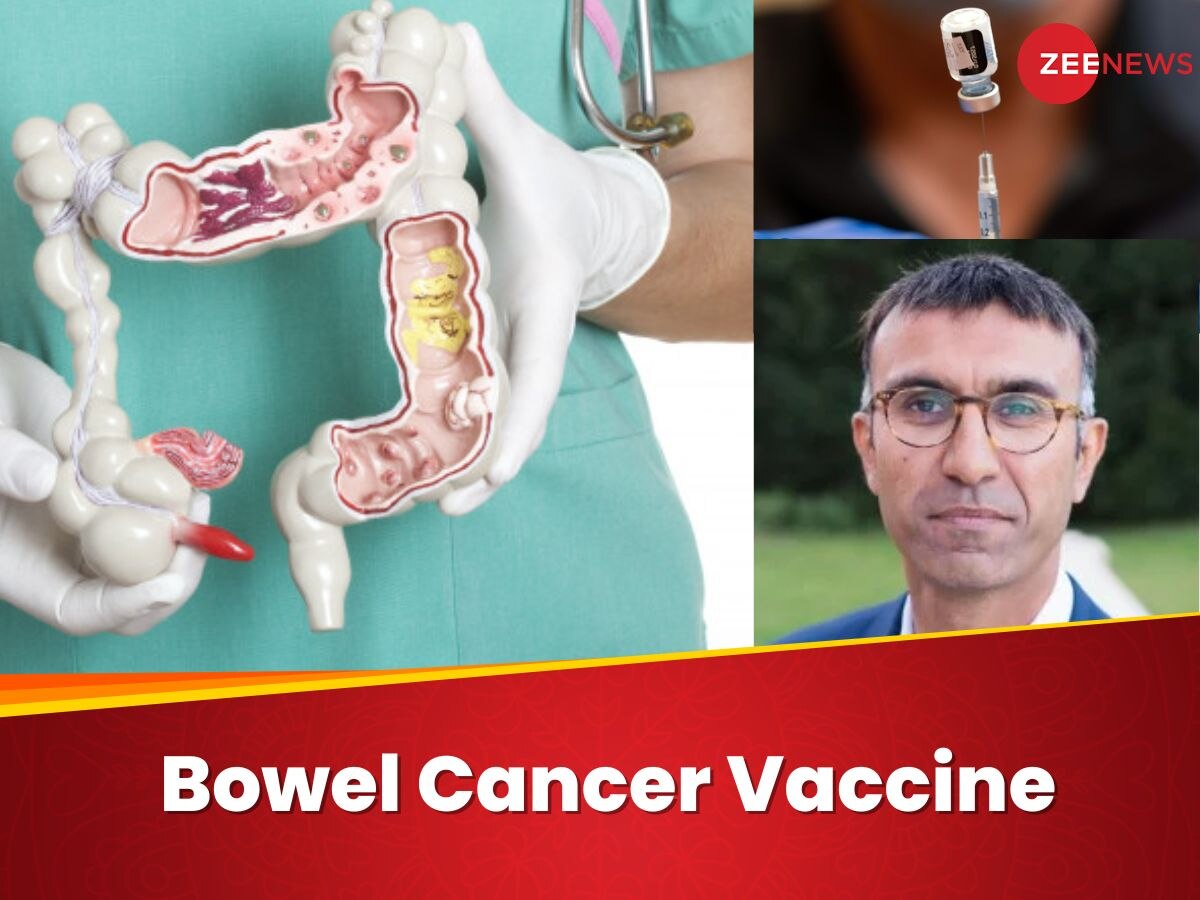 Bowel Cancer की वैक्सीन के ट्रायल में भारतीय मूल के डॉक्टर की अहम भूमिका, 5 सालों तक किया लगातार काम