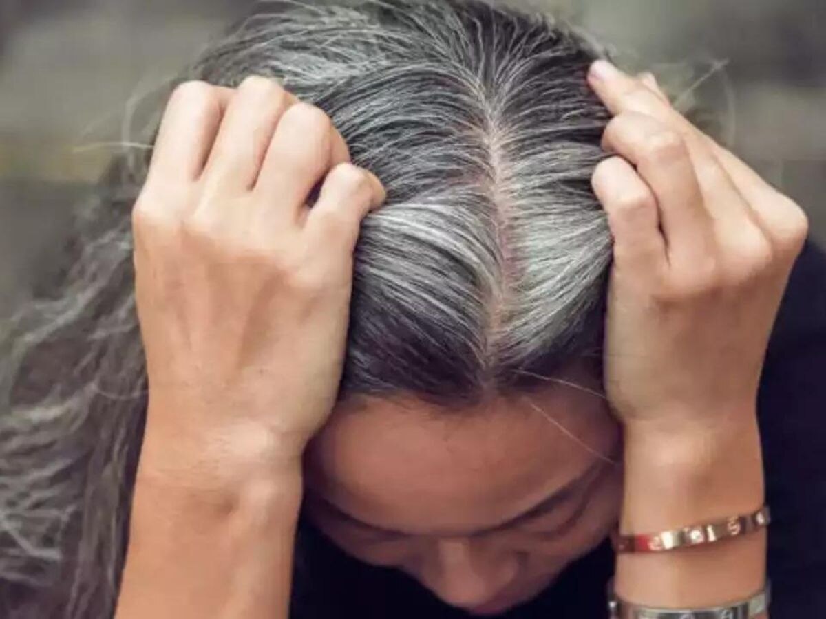 Cause Of Grey Hair: क्यों समय से पहले बूढ़े हो रहे युवा? ये दो चीजें बन रही बड़ी वजह