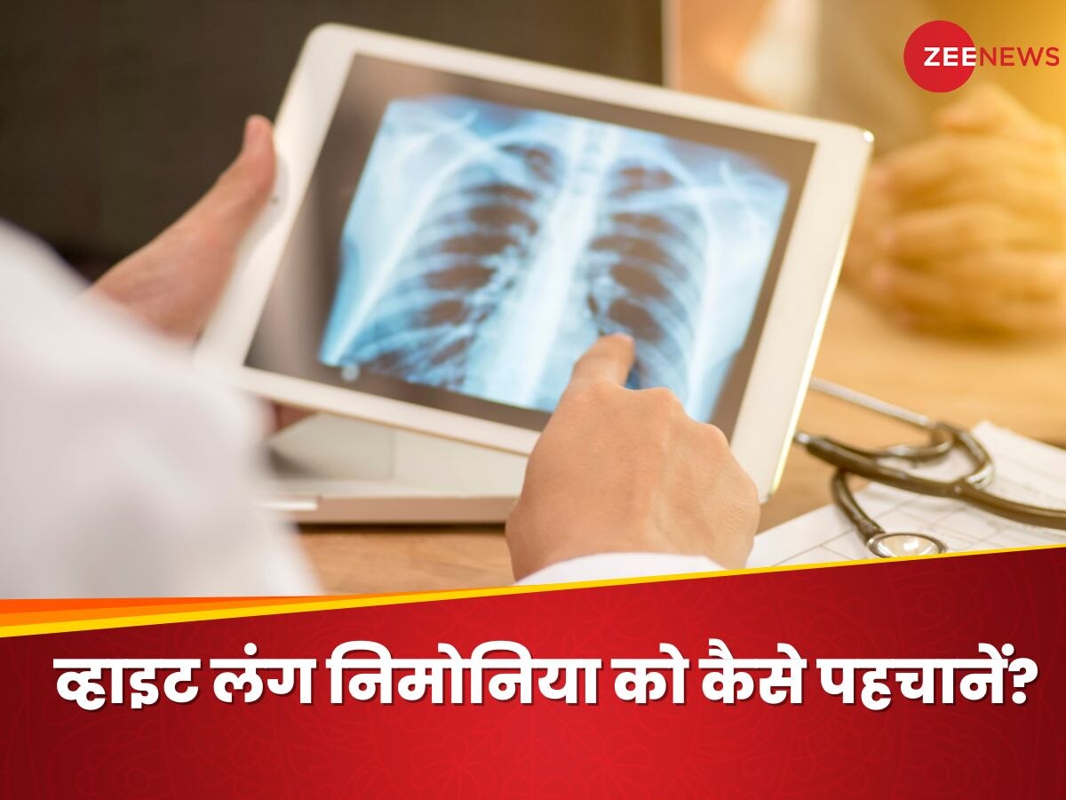 White Lung Pneumonia के इन लक्षणों को कभी न करें नजरअंदाज, कहीं बढ़ न जाए परेशानियां