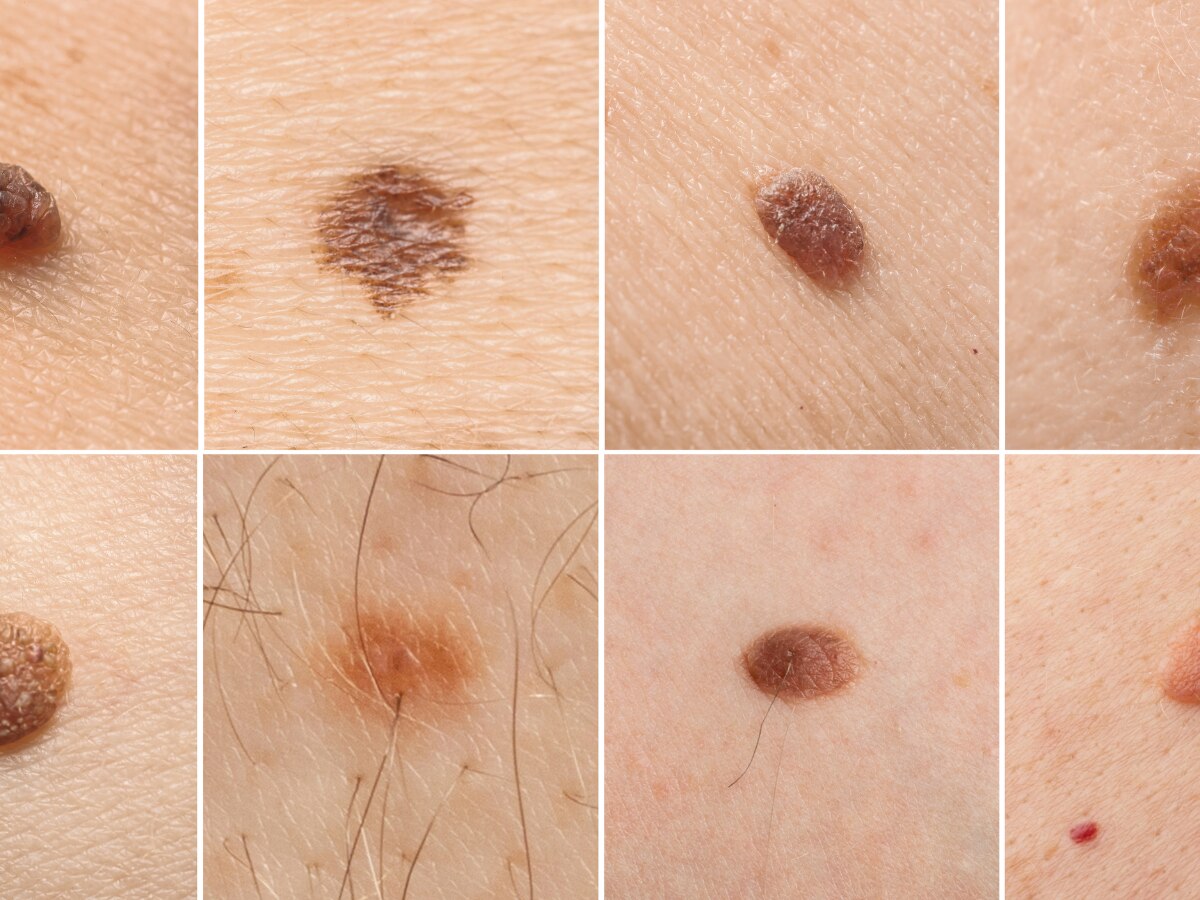 Mole On Body: इन 12 जगहों में से कहां है आपके शरीर पर तिल, जानें अपनी और दूसरों की पर्सनालिटी