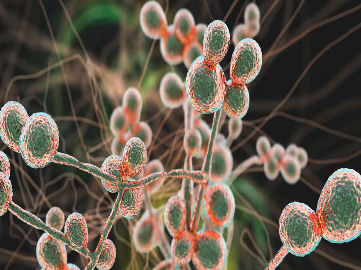 Fungal Infection:ଦୁନିଆରେ ଦ୍ରୁତଗତିରେ ବିସ୍ତାର ହେଉଛି ଏହି ଘାତକ ରୋଗ,ଆମେରିକାରେ ଆତଙ୍କ Fungal Infection:ଦୁନିଆରେ ଦ୍ରୁତଗତିରେ ବିସ୍ତାର ହେଉଛି ଏହି ଘାତକ ରୋଗ,ଆମେରିକାରେ ଆତଙ୍କ