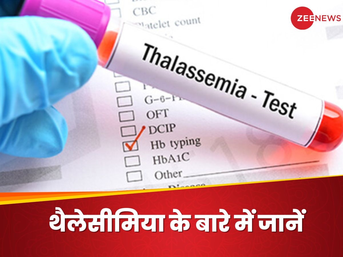 Thalassemia: थैलेसीमिया क्या है? एक्सपर्ट से जानें भारत में इस बीमारी से जुड़ी चुनौतियां
