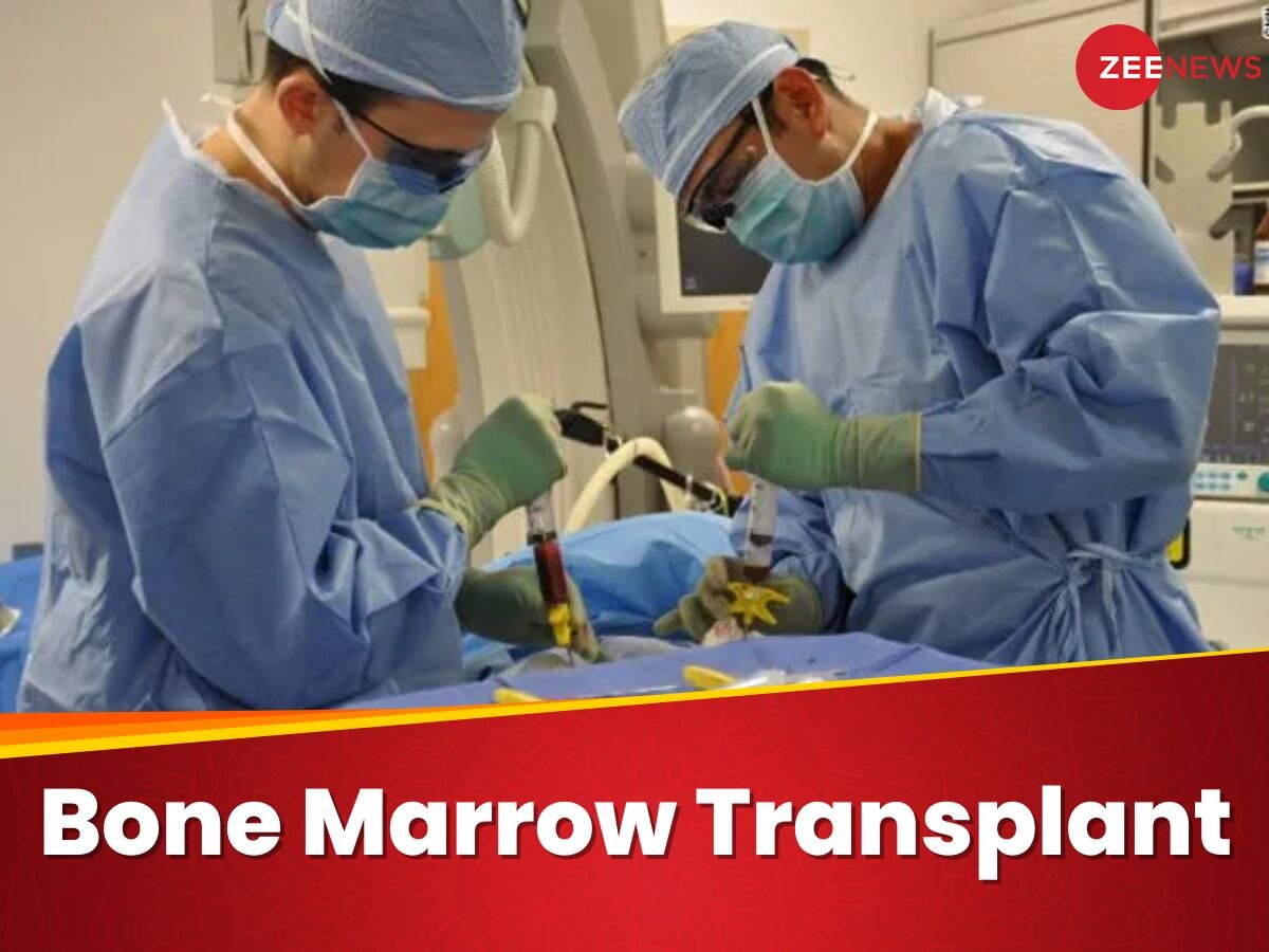 Bone Marrow Transplant: बोन मैरो ट्रांसप्लांट के फायदे और खतरे क्या-क्या हैं?  हेमेटोलॉजिस्ट ने खोले राज़