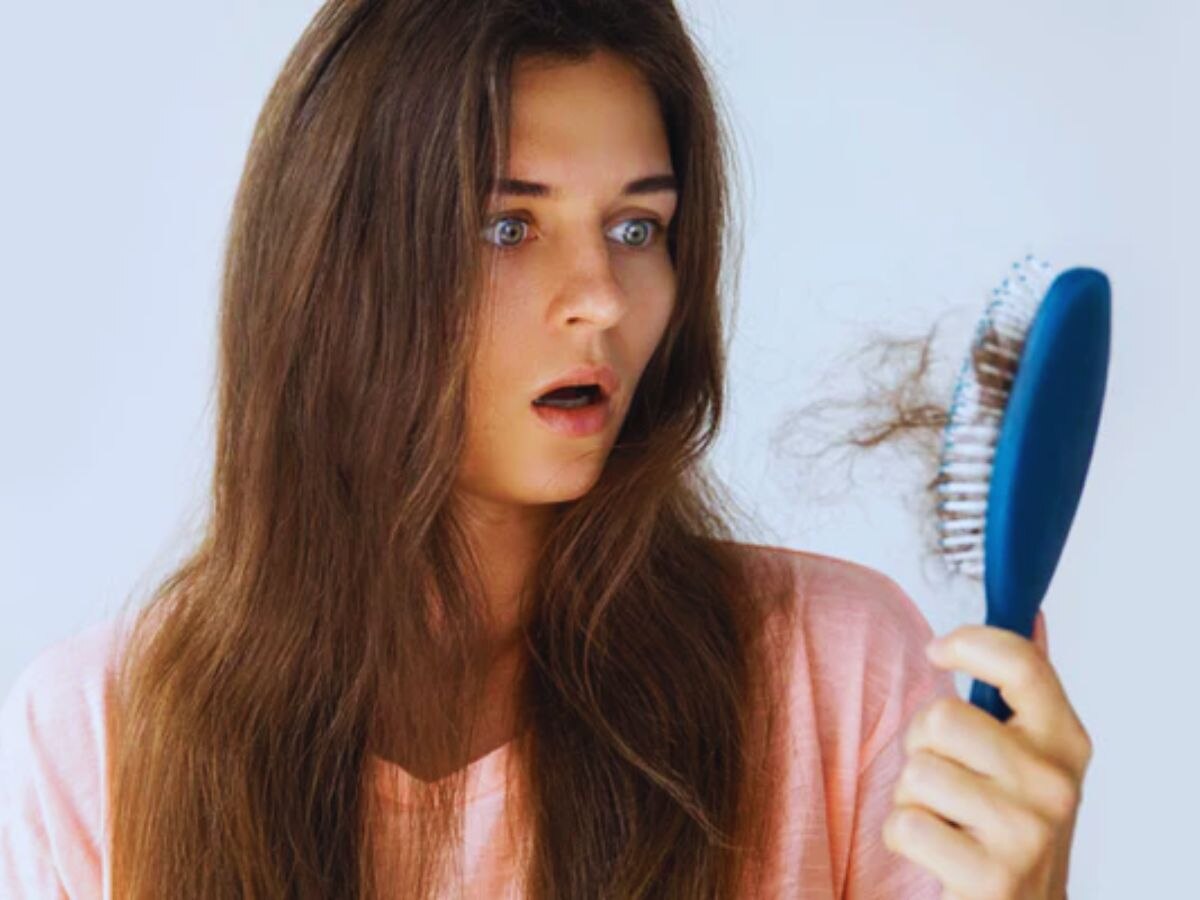 Lifestyle: क्या आपके बाल तेजी से झड़ रहे हैं, इस तरह करें गिरते बालों की रोकथाम