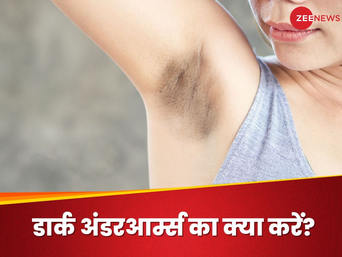 Dark Underarms: अंडरआर्म्स के कालेपन से कैसे पाएं छुटकारा? किचन की इन चीजों से मिल सकता है निखार