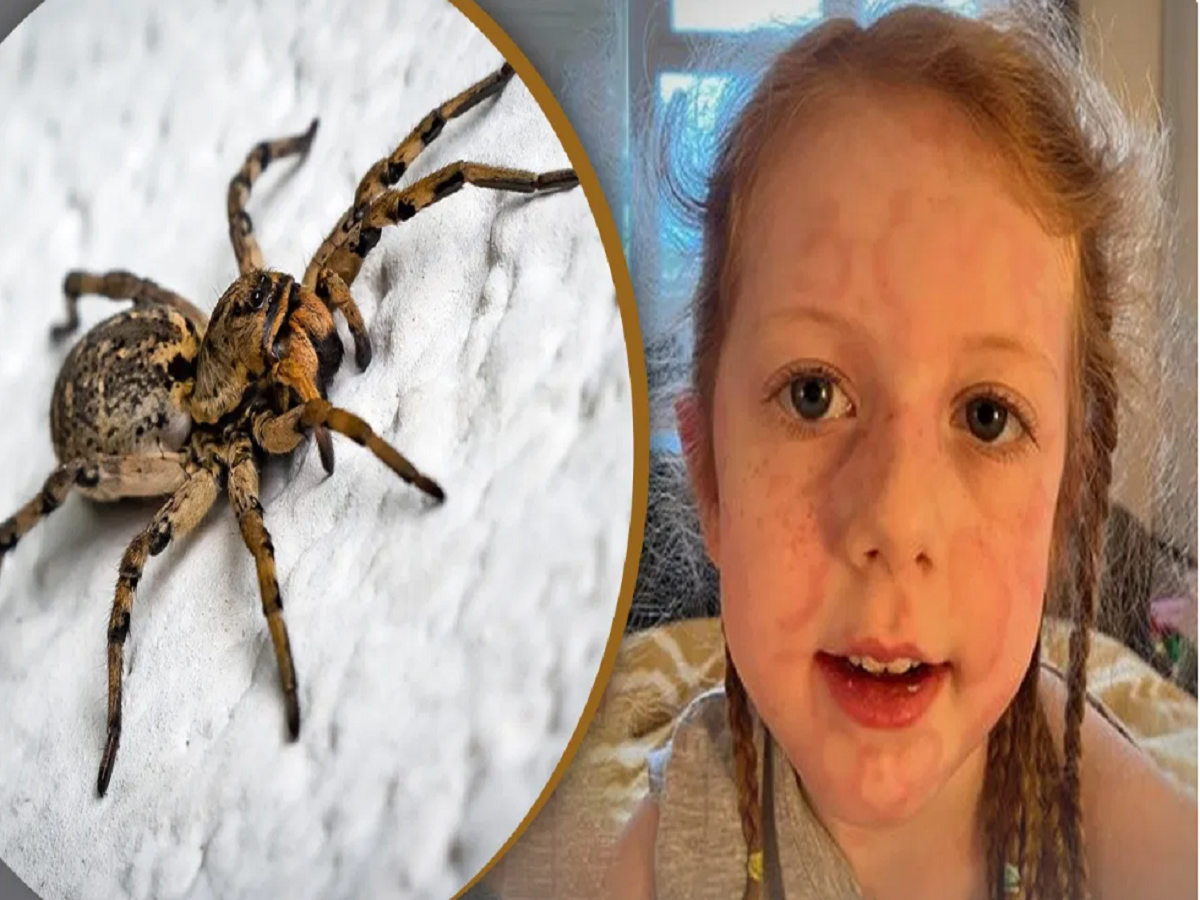 Spider bite:ବୁଢିଆଣି କାମୁଡ଼ାରେ ୫ ବର୍ଷ ଶିଶୁ ହରାଇଲା ଚାଲିବା ଶକ୍ତି ! Spider bite:ବୁଢିଆଣି କାମୁଡ଼ାରେ ୫ ବର୍ଷ ଶିଶୁ ହରାଇଲା ଚାଲିବା ଶକ୍ତି !