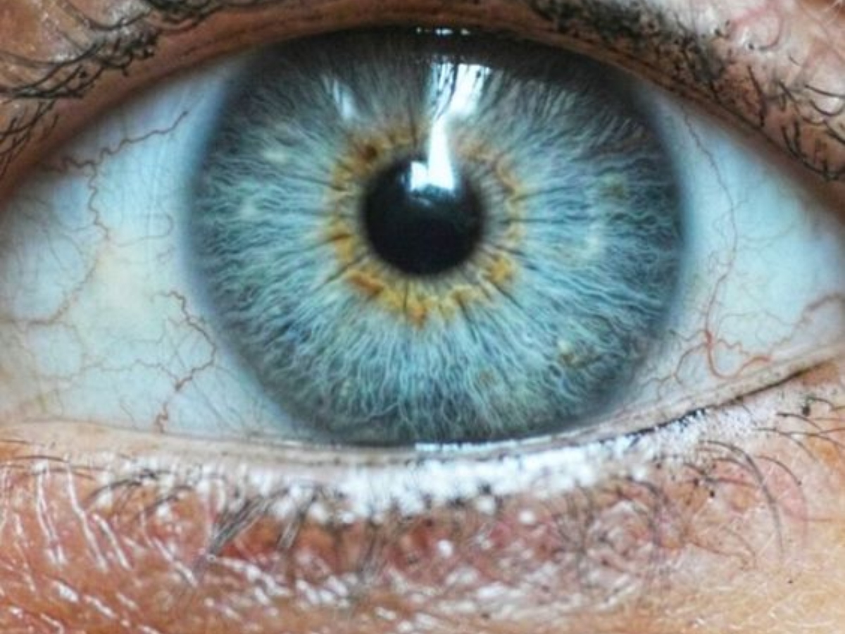 Benefits of eating apple daily: रोजाना सेब का सेवन करने से मिल सकते 5 फायदे, आंखों की रोशनी होगी तेज... 15 आंखों की रोशनी