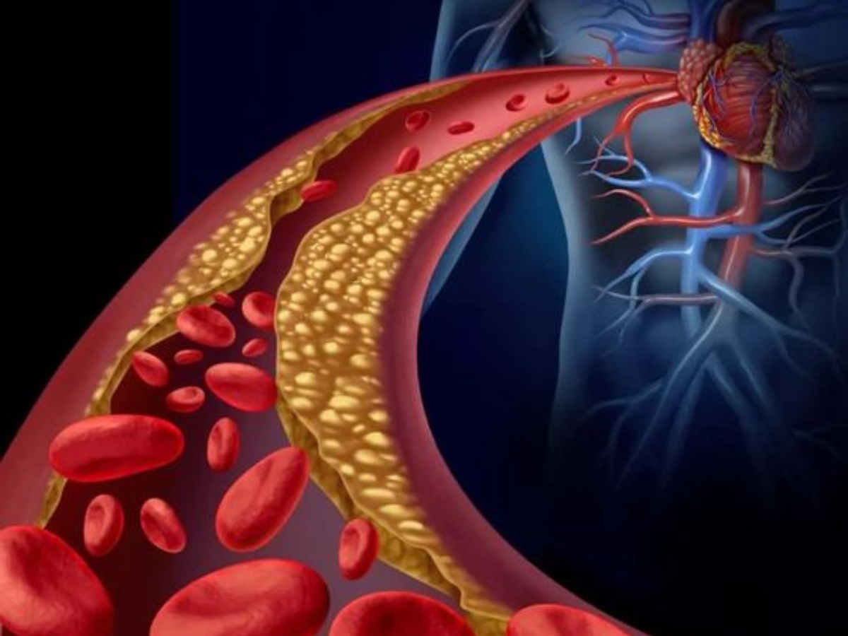 Benefits of eating apple daily: रोजाना सेब का सेवन करने से मिल सकते 5 फायदे, आंखों की रोशनी होगी तेज... 14 कोलेस्ट्रॉल की समस्या