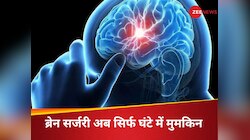 आधे घंटे में दिमाग की सर्जरी करवाएं और काम पर लौट जाएं; ब्रेन ट्यूमर के लिए आई नई टे