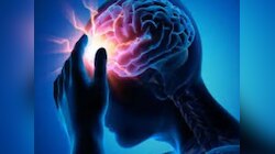 Health News: दिल्ली में अब आधे घंटे में होगा Brain Tumor का इलाज, आई नई तकनीक 