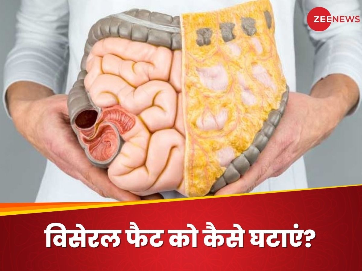 Visceral Fat: आंत की चर्बी हमारे शरीर के लिए क्यों हैं खतरनाक? जानिए इसे कम करने के आसान तरीके