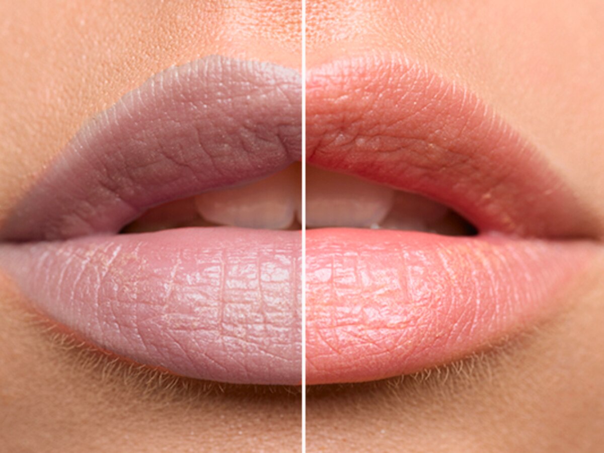 काले होठों को फिर से गुलाबी कैसे करें? इन घरेलू उपायों से मिल सकता मनचाहा रिजल्ट