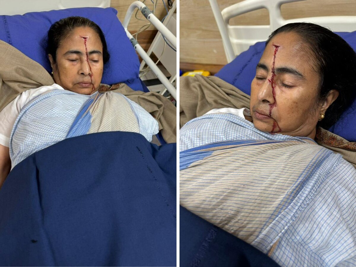 Mamata Banerjee Injury Updates: हादसे का शिकार हुईं ममता बनर्जी, खून से लहूलुहान हुआ सिर