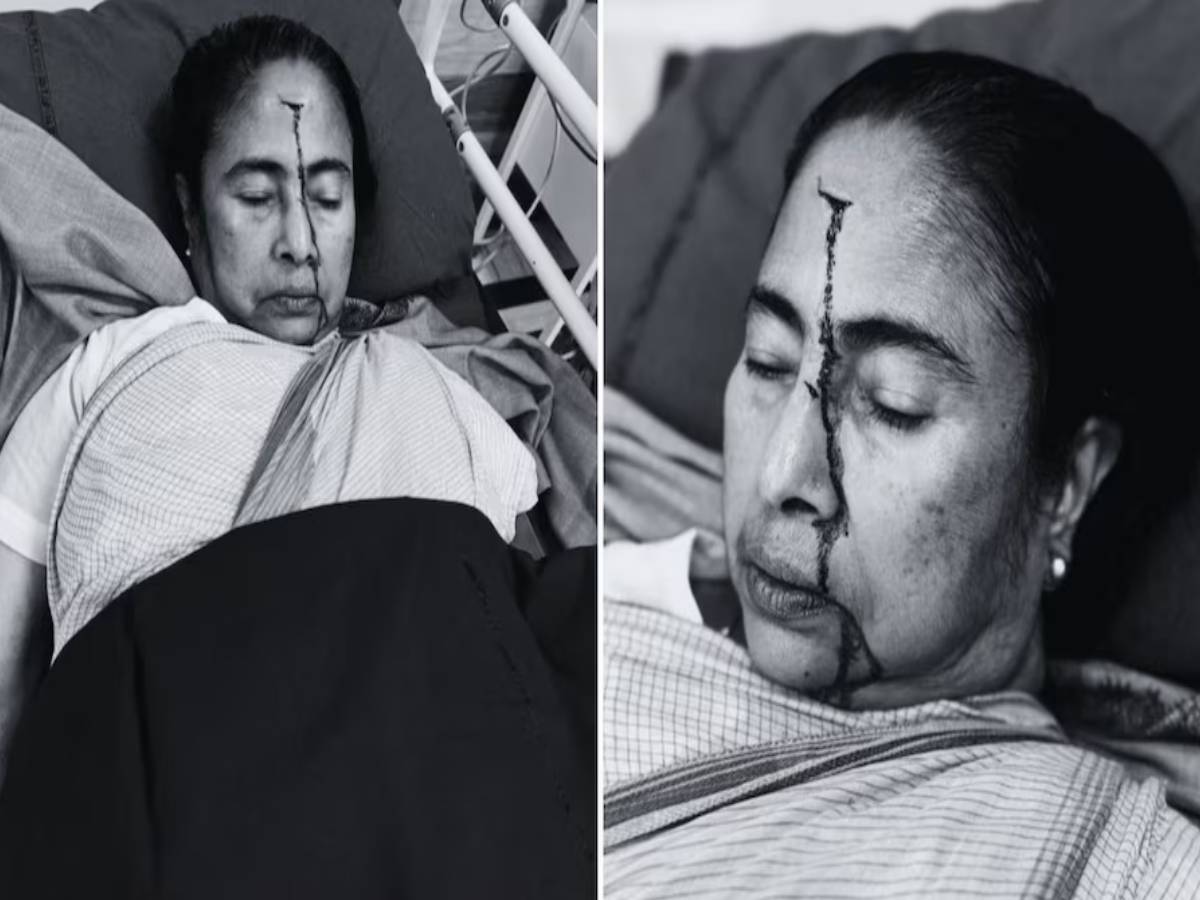 CM ममता बनर्जी की चोट पर डॉक्टर ने किया बड़ा खुलासा; इस थ्योरी की जांच करेगी SIT CM ममता बनर्जी की चोट पर डॉक्टर ने किया बड़ा खुलासा; इस थ्योरी की जांच करेगी SIT