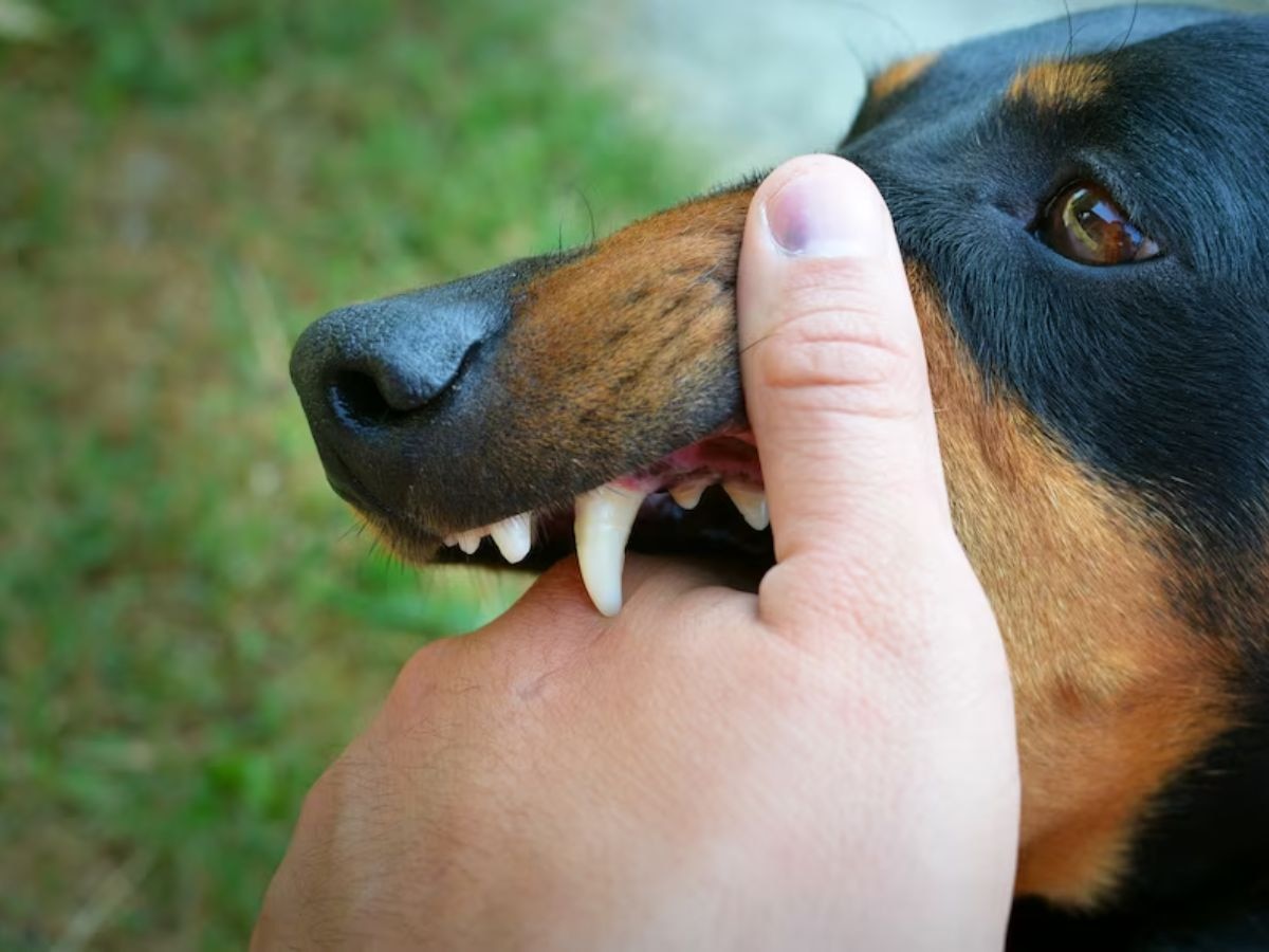 Rabies: कुत्ते के काटने के बाद रेबीज का टीका लगवाने से भी क्या हो सकती है मौत? क्या कहते हैं डॉक्टर