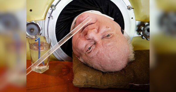 Paul Alexander spent his entire life in iron lungs know his inspiration