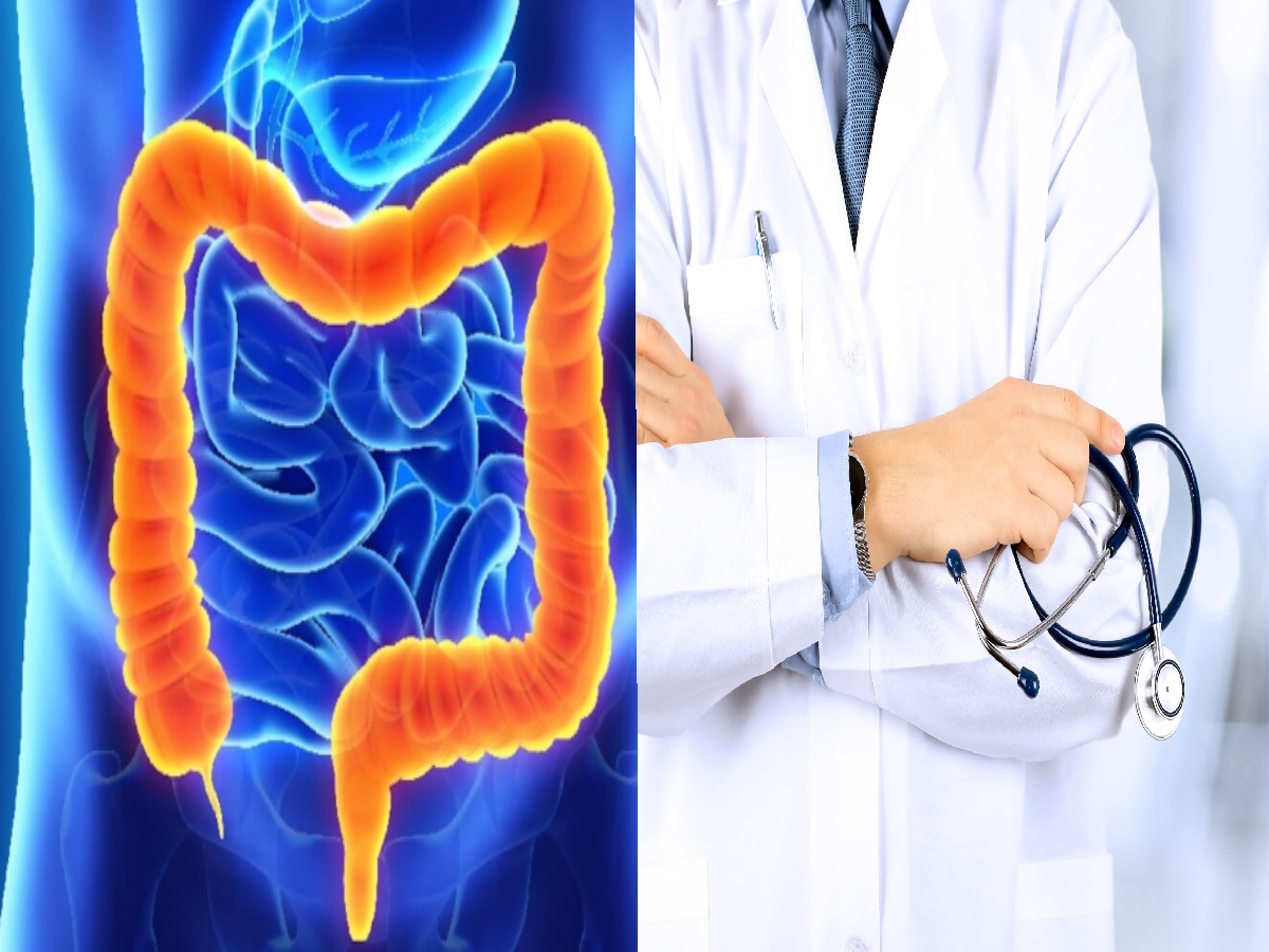 Colorectal cancer : गुरुग्राम की डॉक्टर ने गिनाए कोलोरेक्टल कैंसर के 7 लक्षण, इन्हें भूलकर भी न करें इग्नोर