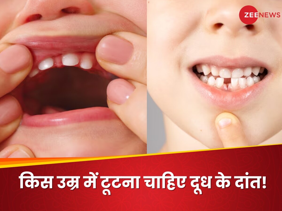 किस उम्र में टूटना चाहिए बच्चों का दूध का दांत, जानें इसके पीछे की बड़ी वजह