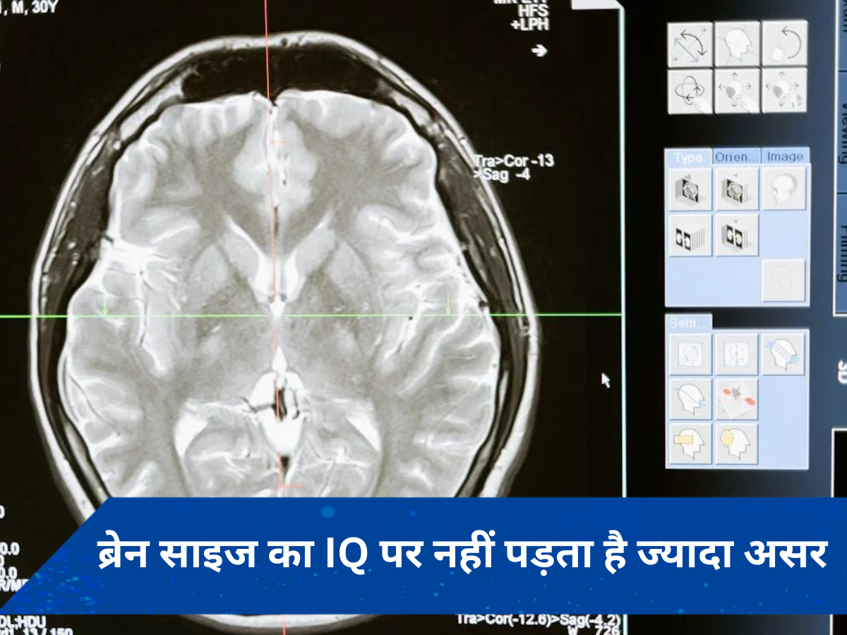 Gen Z के दिमाग का बढ़ रहा है आकार, लेकिन कम हो रहा है IQ,जानें क्या है कारण