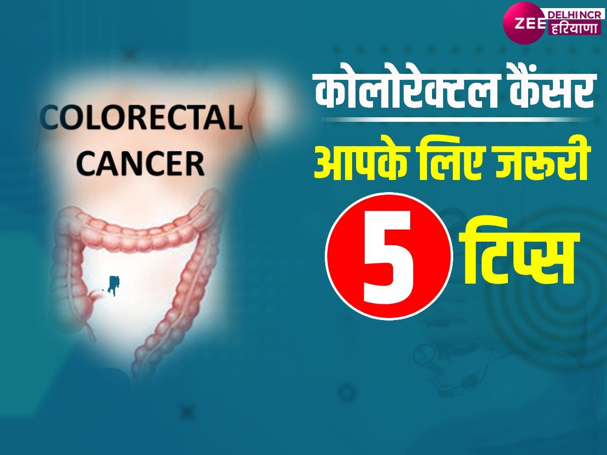 Health Tips: वो 5 कारण जो बढ़ाते हैं Colorectal cancer का खतरा, दिल्ली वाले इस बात का रखें ध्यान