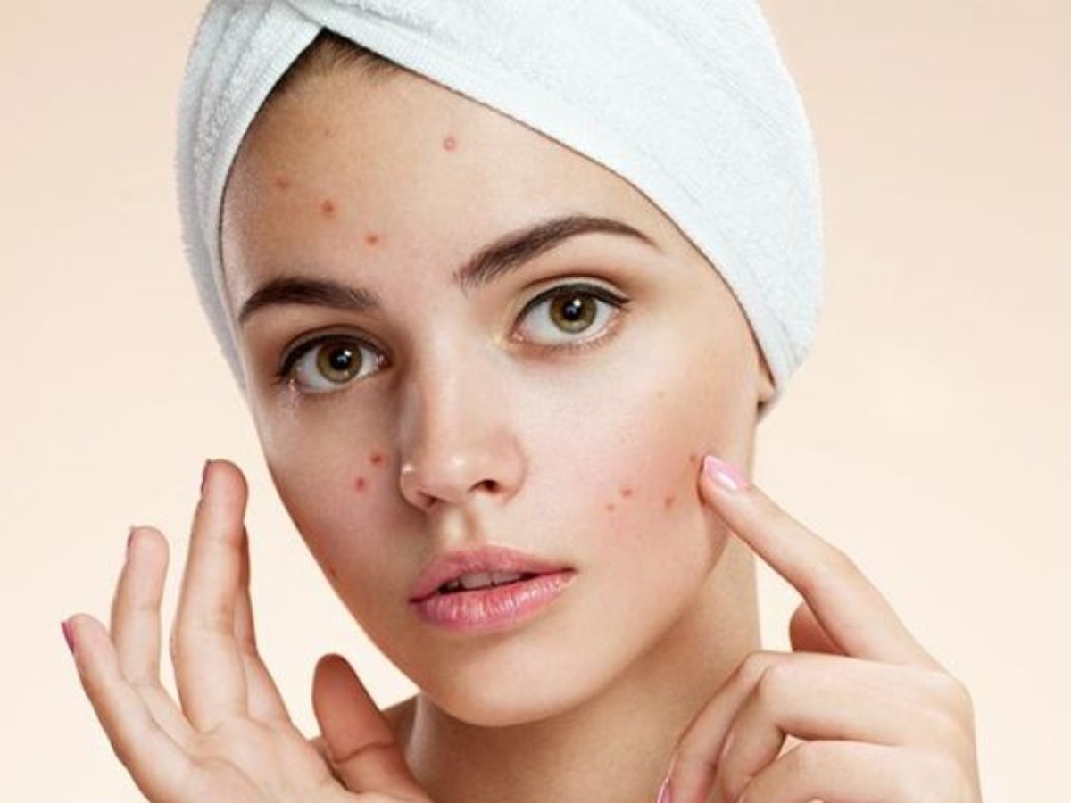 रोजाना सुबह नीम के पत्ते चबाने के फायदे, एक्सपर्ट से जानें सलाह... 12 चेहरे के मुंहासे साफ