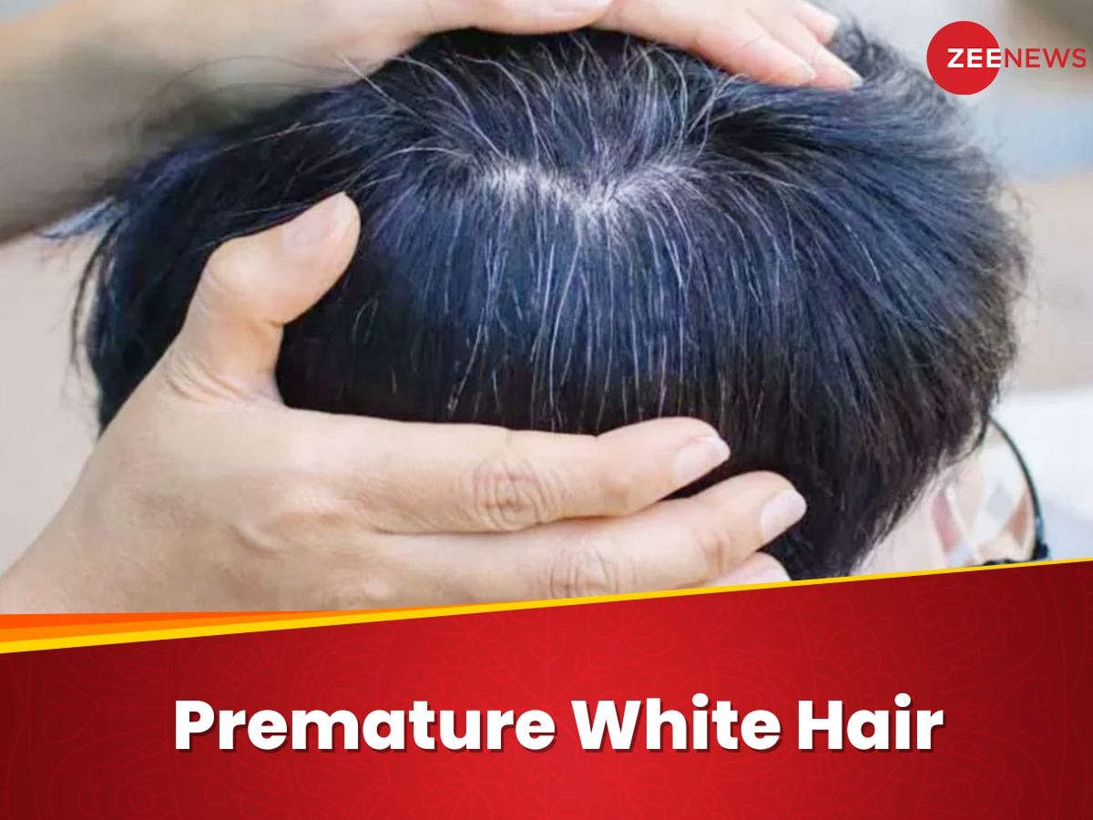 White Hair: इस विटामिन की कमी से भी बाल जल्दी होते हैं सफेद, जानिए कैसे दूर हो सकती है परेशानी