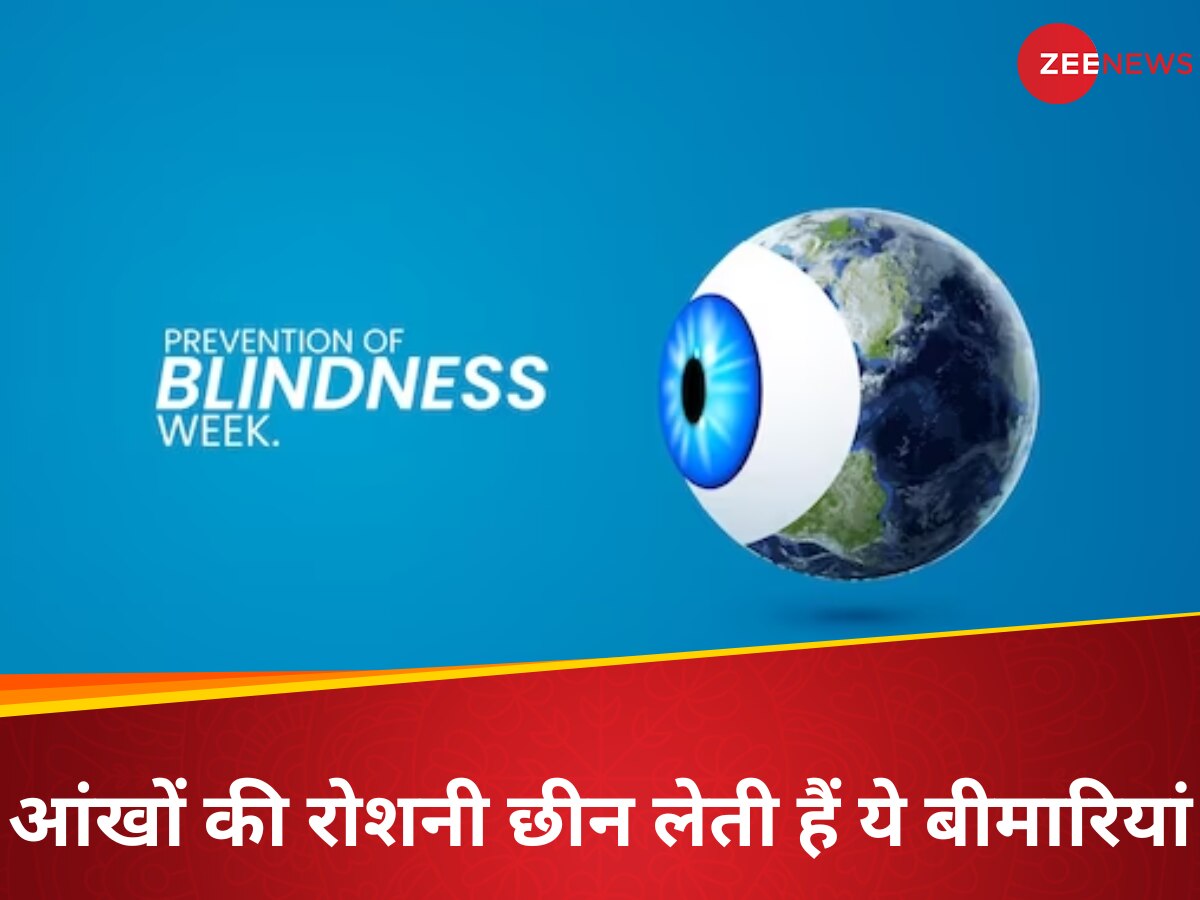 Prevention of Blindness Week: भारत में 40 लाख से ज्यादा लोग अंधे, इन 5 बीमारियों के कारण जाती है सबसे ज्यादा आंखों की रोशनी