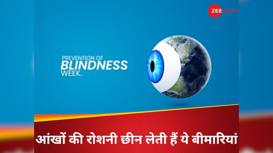 5 common causes of blindness prevalence in india | Prevention of ...
