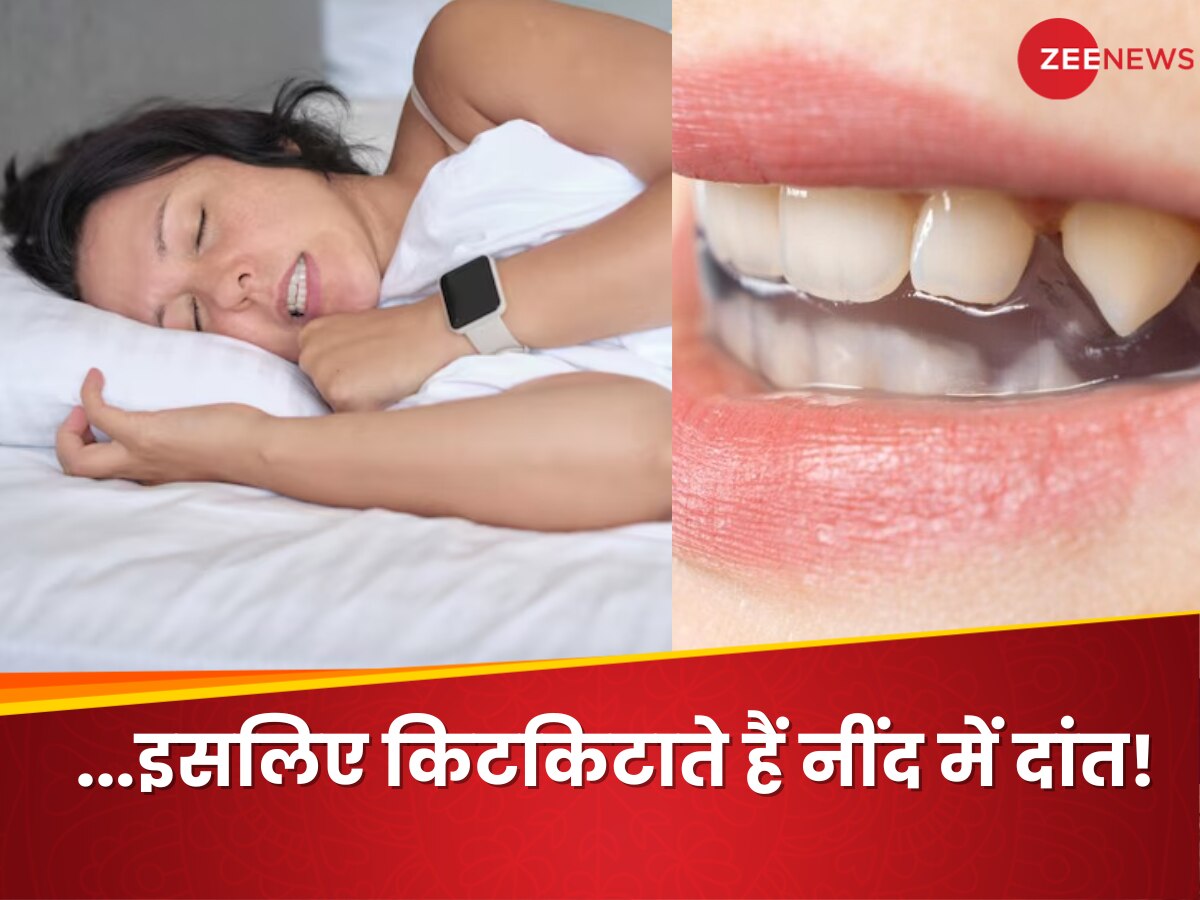 Bruxism: नींद में अपने आप पीसने लगता है दांत! हो सकती है ये गंभीर समस्याएं